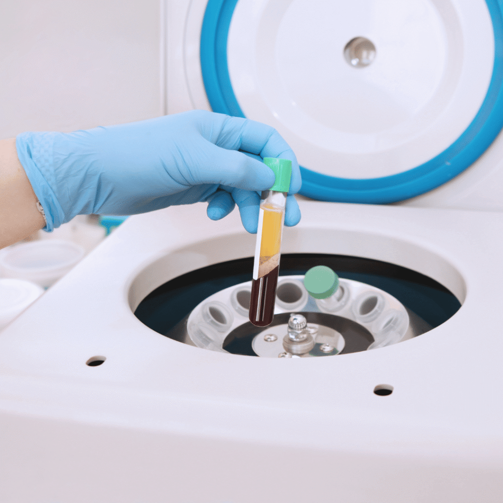 Plasma van bloed in machine