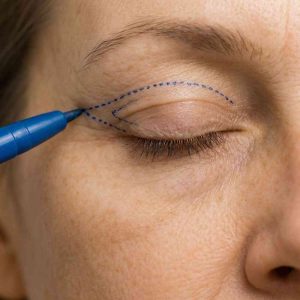 uitleg milaan techniek